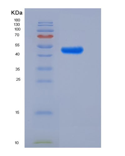 SDS-PAGE analysis of Human LILRA5 (Leukocyte Immunoglobulin-Like Receptor Subfamily A Member 5) - Recombinant Protein, CAT# BLT-05465P, showing >85% purity under 15% SDS-PAGE (Reduced)Human LILRA5 (Leukocyte Immunoglobulin-Like Receptor Subfamily A Member 5) - Recombinant Protein