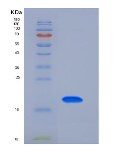 SDS-PAGE analysis of Mouse Tfpi2 (Tissue Factor Pathway Inhibitor 2) - Recombinant Protein, CAT# BLT-05466P, showing >90% purity under 15% SDS-PAGE (Reduced)Mouse Tfpi2 (Tissue Factor Pathway Inhibitor 2) - Recombinant Protein