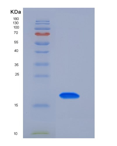 SDS-PAGE analysis of Mouse Tfpi2 (Tissue Factor Pathway Inhibitor 2) - Recombinant Protein, CATMouse Tfpi2 (Tissue Factor Pathway Inhibitor 2) - Recombinant Protein