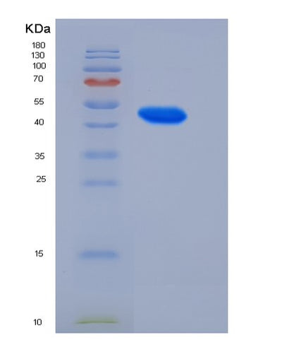 SDS-PAGE analysis of Human GADD45A (Growth Arrest And Dna Damage-Inducible Protein Gadd45 Alpha) - Recombinant Protein, CAT# BLT-05467P, showing >85% purity under 15% SDS-PAGE (Reduced)Human GADD45A (Growth Arrest And Dna Damage-Inducible Protein Gadd45 Alpha) - Recombinant Protein