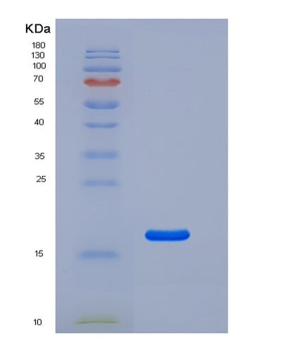 SDS-PAGE analysis of Human CD69 (Early Activation Antigen Cd69) - Recombinant Protein, CAT# BLT-05470P, showing >95% purity under 15% SDS-PAGE (Reduced)Human CD69 (Early Activation Antigen Cd69) - Recombinant Protein