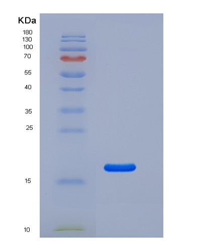 SDS-PAGE analysis of Human CD69 (Early Activation Antigen Cd69) - Recombinant Protein, CATHuman CD69 (Early Activation Antigen Cd69) - Recombinant Protein