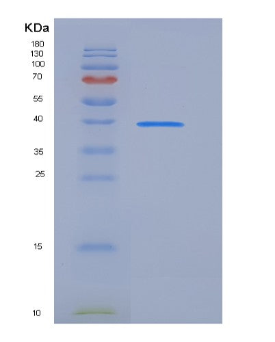 SDS-PAGE analysis of Human SFRP4 (Secreted Frizzled-Related Protein 4) - Recombinant Protein, CATHuman SFRP4 (Secreted Frizzled-Related Protein 4) - Recombinant Protein