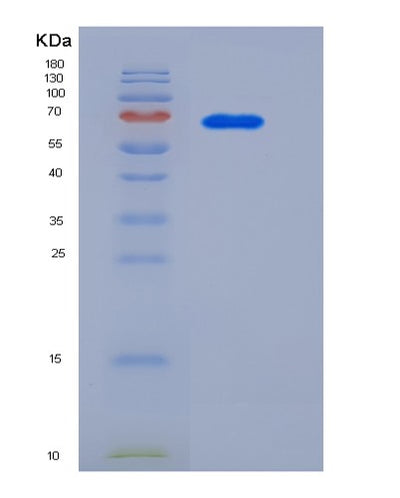 SDS-PAGE analysis of Human AFP (Alpha-Fetoprotein) - Recombinant Protein, CAT# BLT-05475P, showing >85% purity under 15% SDS-PAGE (Reduced)Human AFP (Alpha-Fetoprotein) - Recombinant Protein