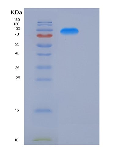 SDS-PAGE analysis of Human KIFBP (Kif-Binding Protein) - Recombinant Protein, CATHuman KIFBP (Kif-Binding Protein) - Recombinant Protein