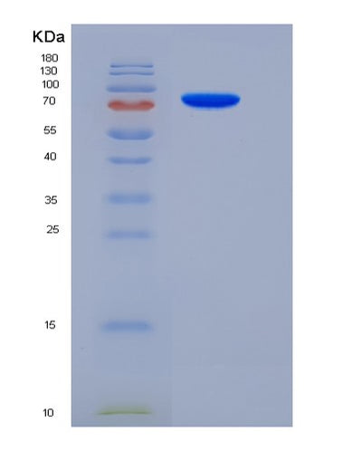 SDS-PAGE analysis of Mouse Sema5a (Semaphorin-5A) - Recombinant Protein, CAT# BLT-05479P, showing >90% purity under 15% SDS-PAGE (Reduced)Mouse Sema5a (Semaphorin-5A) - Recombinant Protein