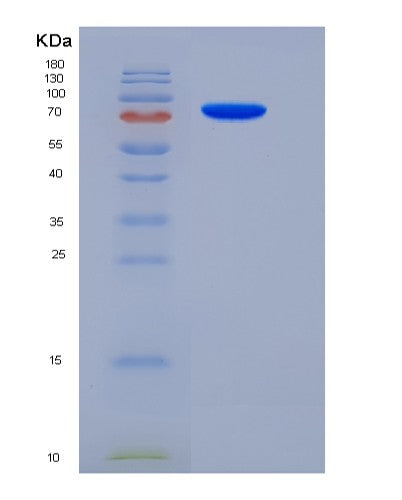 SDS-PAGE analysis of Mouse Sema5a (Semaphorin-5A) - Recombinant Protein, CATMouse Sema5a (Semaphorin-5A) - Recombinant Protein