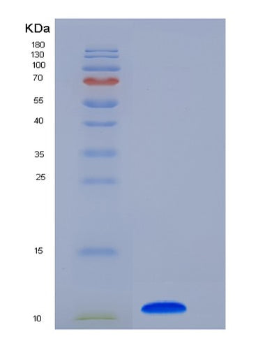 SDS-PAGE analysis of Human COL6A3 (Collagen Alpha-3(Vi) Chain) - Recombinant Protein, CAT# BLT-05480P, showing >85% purity under 15% SDS-PAGE (Reduced)Human COL6A3 (Collagen Alpha-3(Vi) Chain) - Recombinant Protein