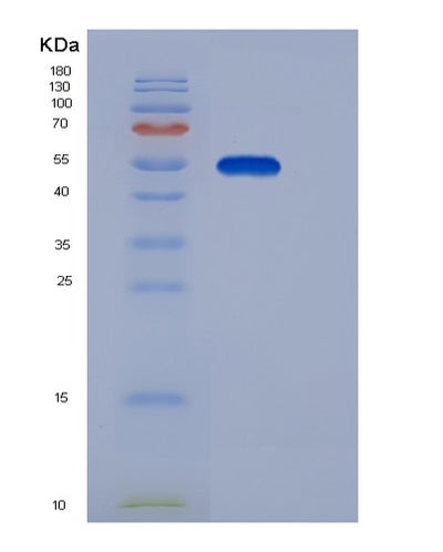 SDS-PAGE analysis of Human EDEM2 (Er Degradation-Enhancing Alpha-Mannosidase-Like Protein 2) - Recombinant Protein, CAT# BLT-05487P, showing >95% purity under 15% SDS-PAGE (Reduced)Human EDEM2 (Er Degradation-Enhancing Alpha-Mannosidase-Like Protein 2) - Recombinant Protein
