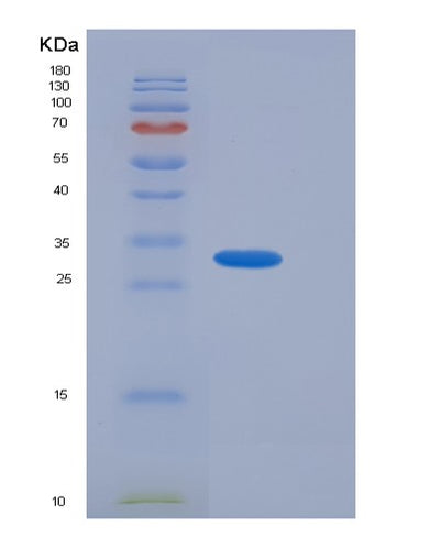SDS-PAGE analysis of Human ACBD6 (Acyl-Coa-Binding Domain-Containing Protein 6) - Recombinant Protein, CAT# BLT-05492P, showing >85% purity under 15% SDS-PAGE (Reduced)Human ACBD6 (Acyl-Coa-Binding Domain-Containing Protein 6) - Recombinant Protein
