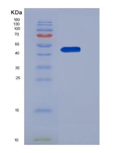 SDS-PAGE analysis of Human SERPINI1 (Neuroserpin) - Recombinant Protein, CAT# BLT-05496P, showing >95% purity under 15% SDS-PAGE (Reduced)Human SERPINI1 (Neuroserpin) - Recombinant Protein