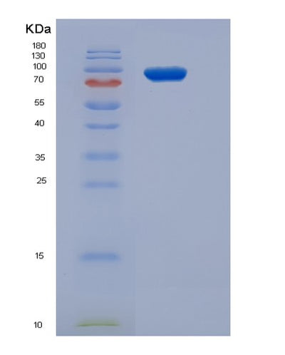SDS-PAGE analysis of Human SRPK3 (Srsf Protein Kinase 3) - Recombinant Protein, CAT# BLT-05501P, showing >85% purity under 15% SDS-PAGE (Reduced)Human SRPK3 (Srsf Protein Kinase 3) - Recombinant Protein