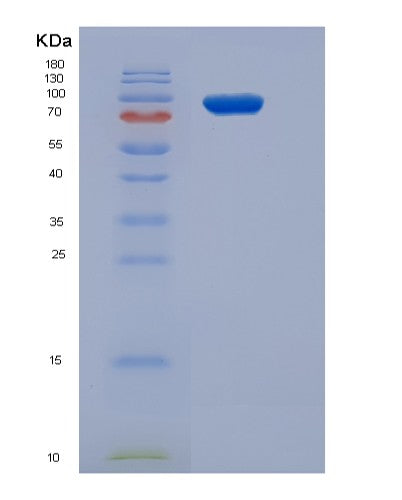 SDS-PAGE analysis of Human SRPK3 (Srsf Protein Kinase 3) - Recombinant Protein, CATHuman SRPK3 (Srsf Protein Kinase 3) - Recombinant Protein