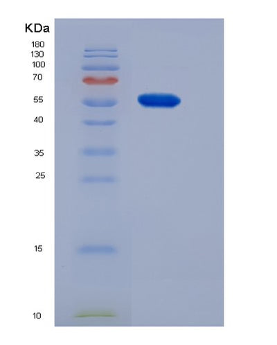 SDS-PAGE analysis of Mouse Cndp1 (Beta-Ala-His Dipeptidase) - Recombinant Protein, CAT# BLT-05502P, showing >90% purity under 15% SDS-PAGE (Reduced)Mouse Cndp1 (Beta-Ala-His Dipeptidase) - Recombinant Protein
