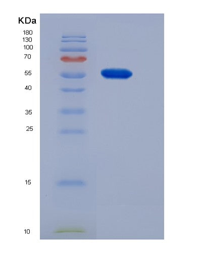 SDS-PAGE analysis of Mouse Cndp1 (Beta-Ala-His Dipeptidase) - Recombinant Protein, CATMouse Cndp1 (Beta-Ala-His Dipeptidase) - Recombinant Protein