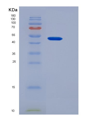 SDS-PAGE analysis of Human SSTR1 (Somatostatin Receptor Type 1) - Recombinant Protein, CATHuman SSTR1 (Somatostatin Receptor Type 1) - Recombinant Protein