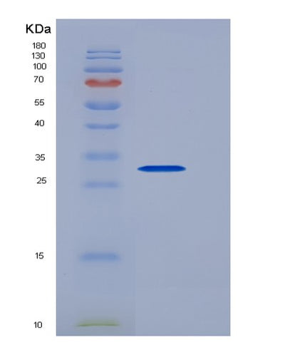SDS-PAGE analysis of Human PCNA (Proliferating Cell Nuclear Antigen) - Recombinant Protein, CAT# BLT-05504P, showing >90% purity under 15% SDS-PAGE (Reduced)Human PCNA (Proliferating Cell Nuclear Antigen) - Recombinant Protein