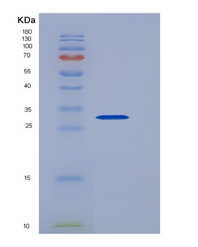 SDS-PAGE analysis of Human PCNA (Proliferating Cell Nuclear Antigen) - Recombinant Protein, CATHuman PCNA (Proliferating Cell Nuclear Antigen) - Recombinant Protein