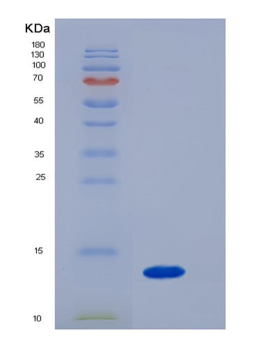 SDS-PAGE analysis of Mouse B2m (Beta-2-Microglobulin) - Recombinant Protein, CAT# BLT-05505P, showing >85% purity under 15% SDS-PAGE (Reduced)Mouse B2m (Beta-2-Microglobulin) - Recombinant Protein