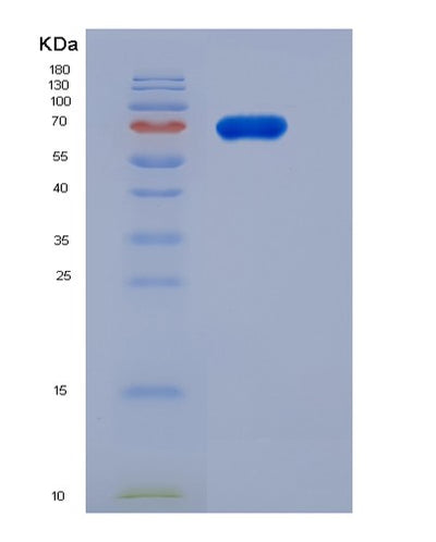 SDS-PAGE analysis of Human FAM20B (Glycosaminoglycan Xylosylkinase) - Recombinant Protein, CAT# BLT-05506P, showing >95% purity under 15% SDS-PAGE (Reduced)Human FAM20B (Glycosaminoglycan Xylosylkinase) - Recombinant Protein