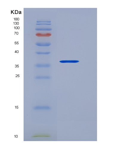 SDS-PAGE analysis of Human RAMP3 (Receptor Activity-Modifying Protein 3) - Recombinant Protein, CATHuman RAMP3 (Receptor Activity-Modifying Protein 3) - Recombinant Protein