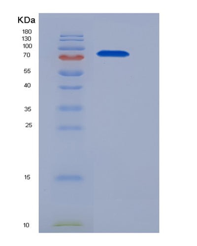 SDS-PAGE analysis of Human CBLC (E3 Ubiquitin-Protein Ligase Cbl-C) - Recombinant Protein, CAT# BLT-05511P, showing >85% purity under 15% SDS-PAGE (Reduced)Human CBLC (E3 Ubiquitin-Protein Ligase Cbl-C) - Recombinant Protein
