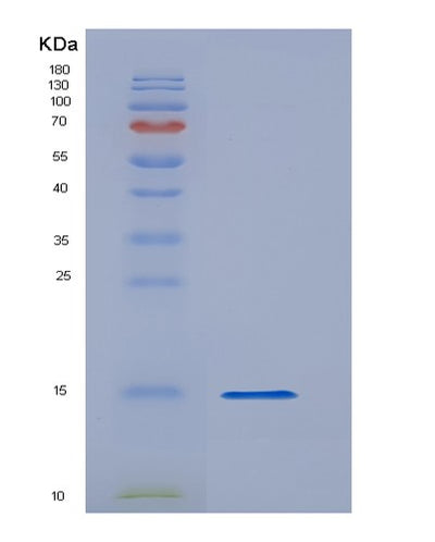 SDS-PAGE analysis of Human ALKAL1 (Alk And Ltk Ligand 1) - Recombinant Protein, CAT# BLT-05517P, showing >85% purity under 15% SDS-PAGE (Reduced)Human ALKAL1 (Alk And Ltk Ligand 1) - Recombinant Protein