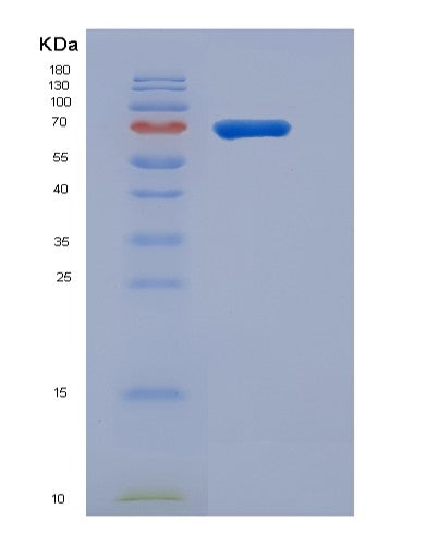 SDS-PAGE analysis of Mouse Vnn1 (Pantetheinase) - Recombinant Protein, CATMouse Vnn1 (Pantetheinase) - Recombinant Protein