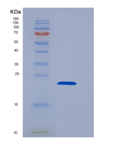 SDS-PAGE analysis of Human PPP3R1 (Calcineurin Subunit B Type 1) - Recombinant Protein, CAT# BLT-05519P, showing >85% purity under 15% SDS-PAGE (Reduced)Human PPP3R1 (Calcineurin Subunit B Type 1) - Recombinant Protein