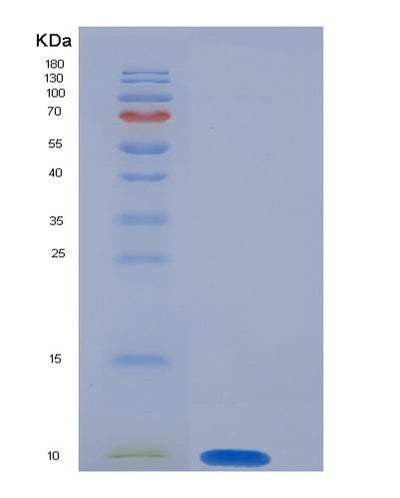 SDS-PAGE analysis of Mouse S100a6 (Protein S100-A6) - Recombinant Protein, CAT# BLT-05521P, showing >85% purity under 15% SDS-PAGE (Reduced)Mouse S100a6 (Protein S100-A6) - Recombinant Protein