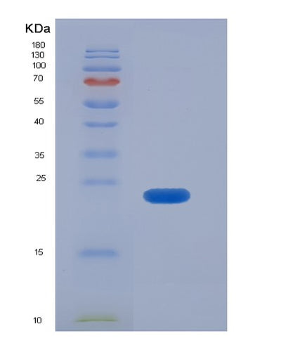SDS-PAGE analysis of Human RAB31 (Ras-Related Protein Rab-31) - Recombinant Protein, CAT# BLT-05524P, showing >85% purity under 15% SDS-PAGE (Reduced)Human RAB31 (Ras-Related Protein Rab-31) - Recombinant Protein