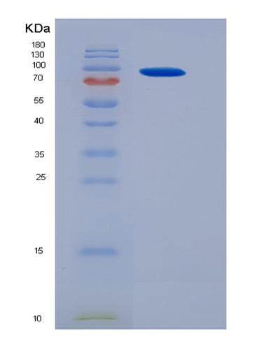 SDS-PAGE analysis of Mouse Ncstn (Nicastrin) - Recombinant Protein, CAT# BLT-05527P, showing >95% purity under 15% SDS-PAGE (Reduced)Mouse Ncstn (Nicastrin) - Recombinant Protein