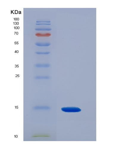 SDS-PAGE analysis of Human PTRH2 (Peptidyl-Trna Hydrolase 2, Mitochondrial) - Recombinant Protein, CAT# BLT-05528P, showing >90% purity under 15% SDS-PAGE (Reduced)Human PTRH2 (Peptidyl-Trna Hydrolase 2, Mitochondrial) - Recombinant Protein