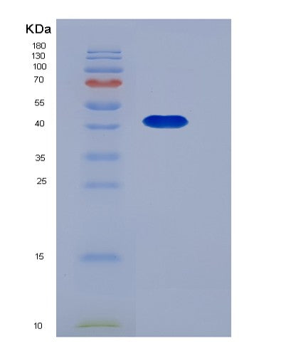 SDS-PAGE analysis of Mouse Serpinb8 (Serpin B8) - Recombinant Protein, CATMouse Serpinb8 (Serpin B8) - Recombinant Protein