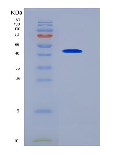SDS-PAGE analysis of Mouse Serpini1 (Neuroserpin) - Recombinant Protein, CAT# BLT-05535P, showing >85% purity under 15% SDS-PAGE (Reduced)Mouse Serpini1 (Neuroserpin) - Recombinant Protein