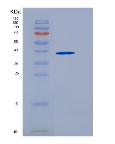 SDS-PAGE analysis of Human ART3 (Ecto-Adp-Ribosyltransferase 3) - Recombinant Protein, CAT# BLT-05537P, showing >90% purity under 15% SDS-PAGE (Reduced)Human ART3 (Ecto-Adp-Ribosyltransferase 3) - Recombinant Protein