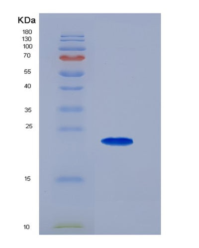 SDS-PAGE analysis of Human EDNRB (Endothelin Receptor Type B) - Recombinant Protein, CAT# BLT-05539P, showing >95% purity under 15% SDS-PAGE (Reduced)Human EDNRB (Endothelin Receptor Type B) - Recombinant Protein