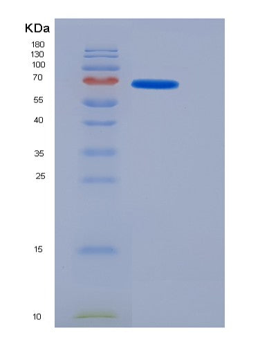 SDS-PAGE analysis of Mouse Mep1a (Meprin A Subunit Alpha) - Recombinant Protein, CATMouse Mep1a (Meprin A Subunit Alpha) - Recombinant Protein