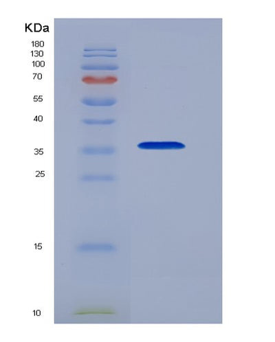 SDS-PAGE analysis of Human NFKBIA (Nf-Kappa-B Inhibitor Alpha) - Recombinant Protein, CAT# BLT-05556P, showing >85% purity under 15% SDS-PAGE (Reduced)Human NFKBIA (Nf-Kappa-B Inhibitor Alpha) - Recombinant Protein