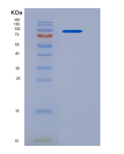 SDS-PAGE analysis of Human PDIA4 (Protein Disulfide-Isomerase A4) - Recombinant Protein, CATHuman PDIA4 (Protein Disulfide-Isomerase A4) - Recombinant Protein