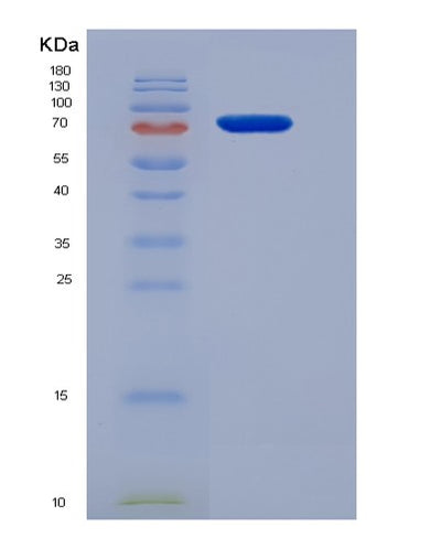 SDS-PAGE analysis of Mouse Ccne1 (G1/S-Specific Cyclin-E1) - Recombinant Protein, CAT# BLT-05557P, showing >90% purity under 15% SDS-PAGE (Reduced)Mouse Ccne1 (G1/S-Specific Cyclin-E1) - Recombinant Protein