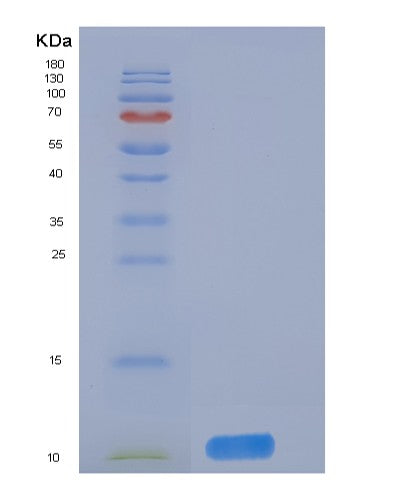 SDS-PAGE analysis of Human DNAJC30 (Dnaj Homolog Subfamily C Member 30, Mitochondrial) - Recombinant Protein, CATHuman DNAJC30 (Dnaj Homolog Subfamily C Member 30, Mitochondrial) - Recombinant Protein