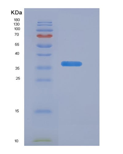 SDS-PAGE analysis of Human CALCB (Calcitonin Gene-Related Peptide 2) - Recombinant Protein, CAT# BLT-05563P, showing >95% purity under 15% SDS-PAGE (Reduced)Human CALCB (Calcitonin Gene-Related Peptide 2) - Recombinant Protein