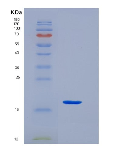 SDS-PAGE analysis of Human KCT2 (Keratinocyte-Associated Transmembrane Protein 2) - Recombinant Protein, CATHuman KCT2 (Keratinocyte-Associated Transmembrane Protein 2) - Recombinant Protein