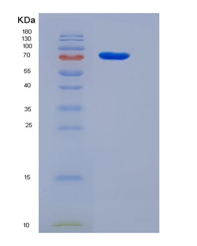 SDS-PAGE analysis of Human PRC1 (Protein Regulator Of Cytokinesis 1) - Recombinant Protein, CAT# BLT-05565P, showing >85% purity under 15% SDS-PAGE (Reduced)Human PRC1 (Protein Regulator Of Cytokinesis 1) - Recombinant Protein