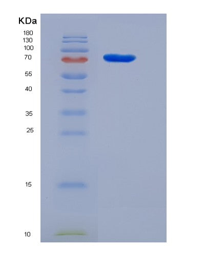 SDS-PAGE analysis of Human PRC1 (Protein Regulator Of Cytokinesis 1) - Recombinant Protein, CATHuman PRC1 (Protein Regulator Of Cytokinesis 1) - Recombinant Protein