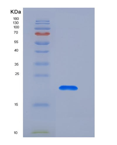 SDS-PAGE analysis of Human CNPY2 (Protein Canopy Homolog 2) - Recombinant Protein, CAT# BLT-05566P, showing >90% purity under 15% SDS-PAGE (Reduced)Human CNPY2 (Protein Canopy Homolog 2) - Recombinant Protein