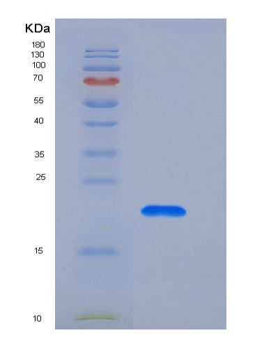 SDS-PAGE analysis of Human CNPY2 (Protein Canopy Homolog 2) - Recombinant Protein, CATHuman CNPY2 (Protein Canopy Homolog 2) - Recombinant Protein
