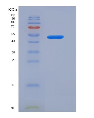 SDS-PAGE analysis of Mouse Il10rb (Interleukin-10 Receptor Subunit Beta) - Recombinant Protein, CAT# BLT-05570P, showing >85% purity under 15% SDS-PAGE (Reduced)Mouse Il10rb (Interleukin-10 Receptor Subunit Beta) - Recombinant Protein
