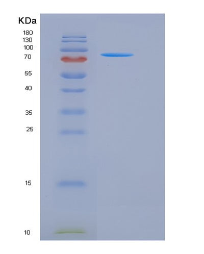 SDS-PAGE analysis of Mouse Camk4 (Calcium/Calmodulin-Dependent Protein Kinase Type Iv) - Recombinant Protein, CAT# BLT-05577P, showing >90% purity under 15% SDS-PAGE (Reduced)Mouse Camk4 (Calcium/Calmodulin-Dependent Protein Kinase Type Iv) - Recombinant Protein